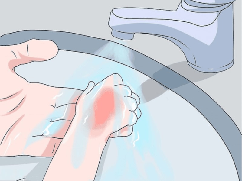 Bỏng Hoá Chất Là Gì