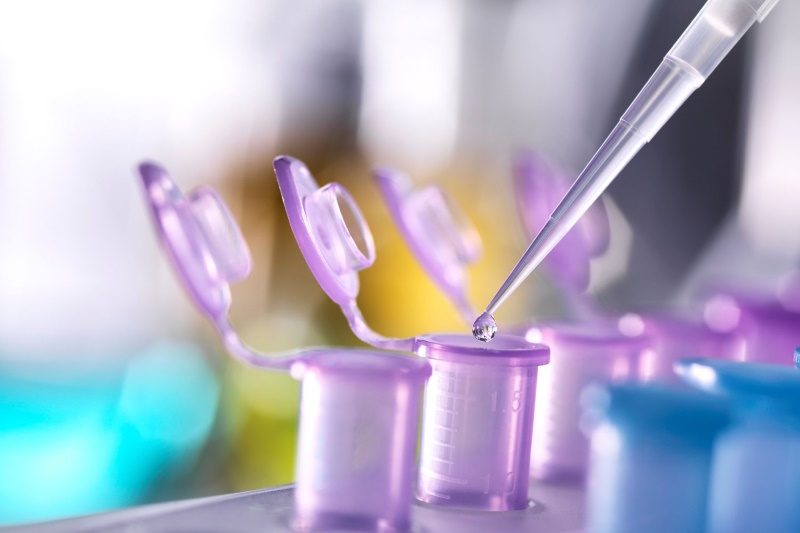 1 Lít Bằng Bao Nhiêu Microlit​